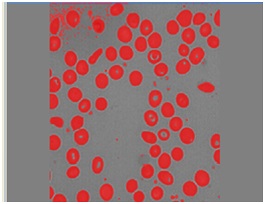image processing india image processing india